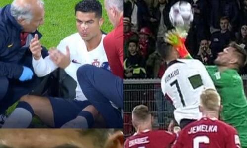 Σοβαρός τραυματισμός του Ρονάλντο από τον Βατσλίκ: Αποχώρησε αιμόφυρτος (vids) thumb