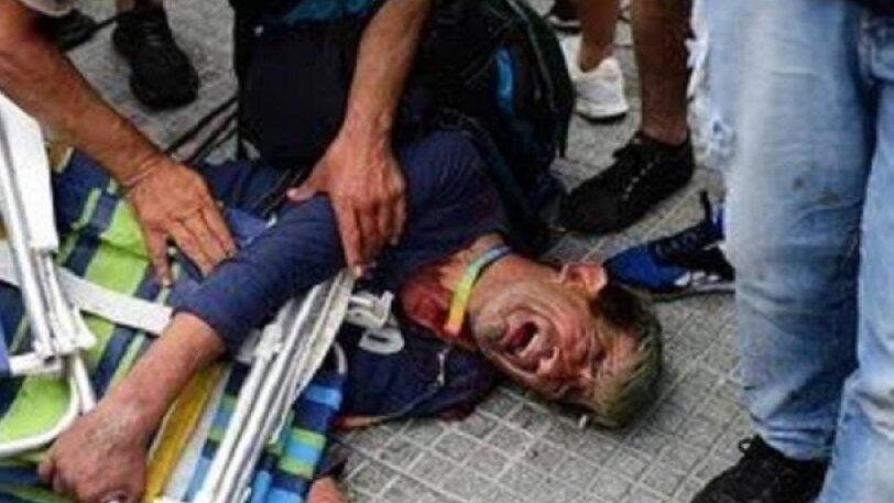 Μαραντόνα: Δακρυγόνα, τραυματίες και συλλήψεις στο λαϊκό προσκύνημα! thumb