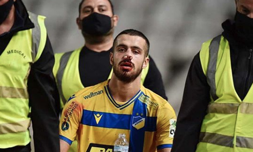 Απέφυγε τα χειρότερα και είναι καλά ο Ζόρζε (pic) thumb