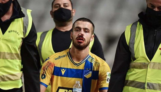 Απέφυγε τα χειρότερα και είναι καλά ο Ζόρζε (pic) thumb